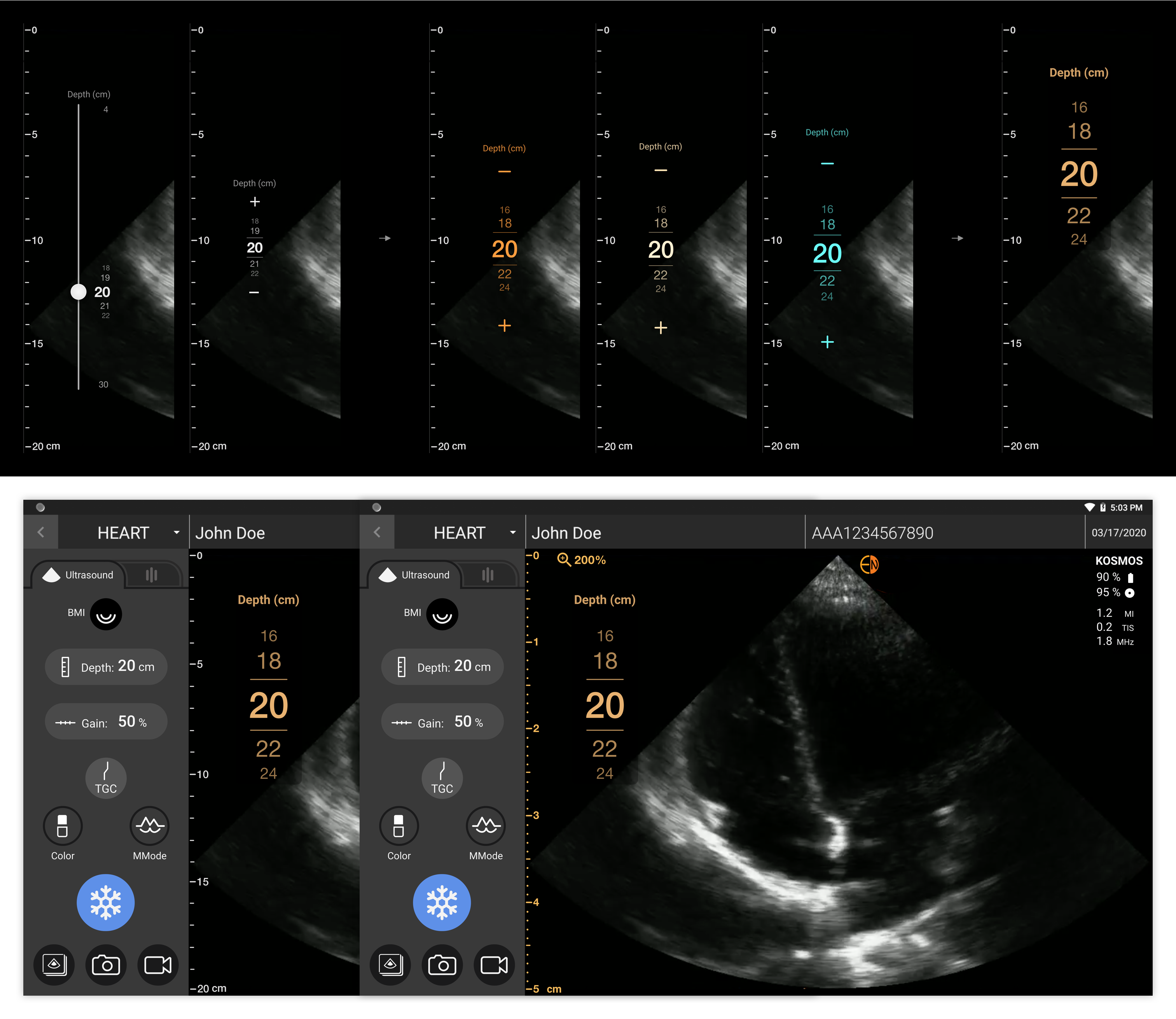 Depth Control Iteration