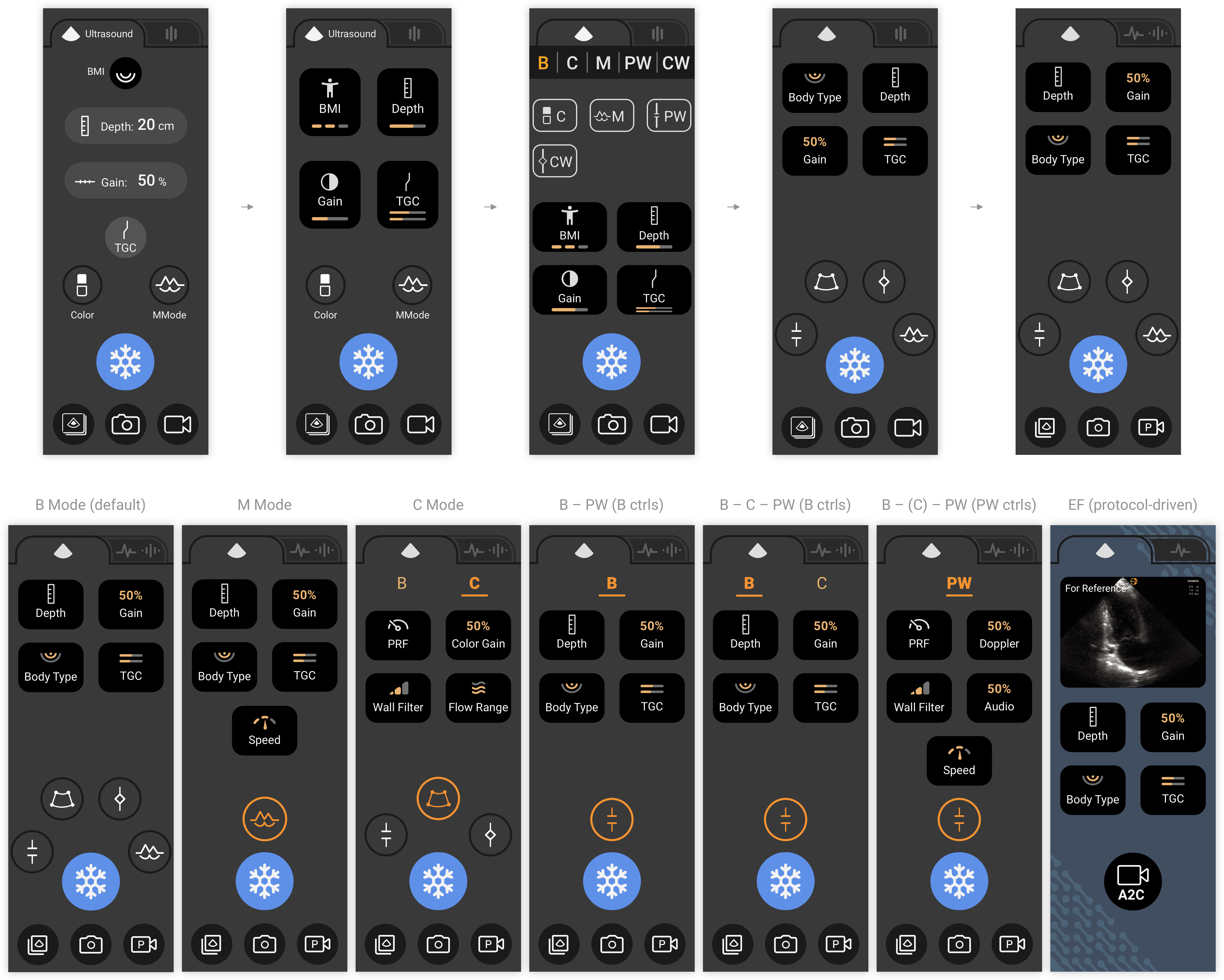 Ultrasound Control Panel Iteration