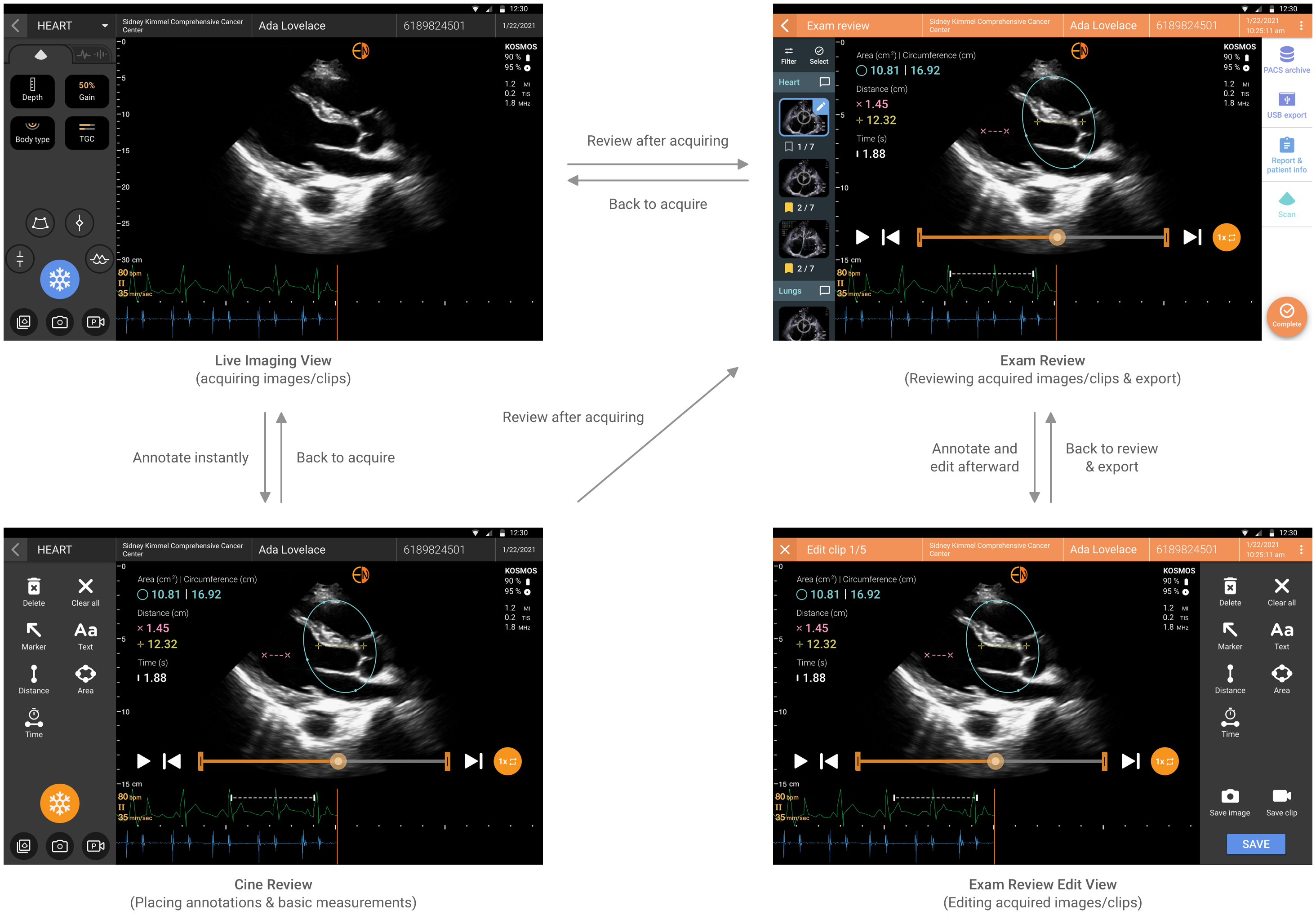 Interaction Map