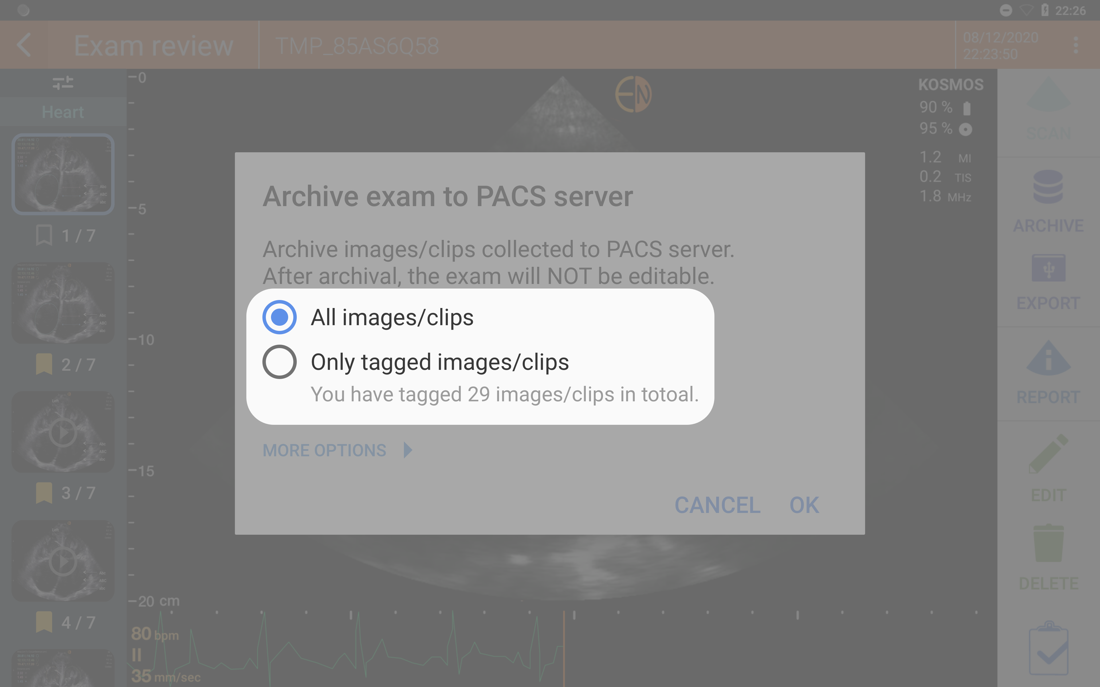 Archive to PACS