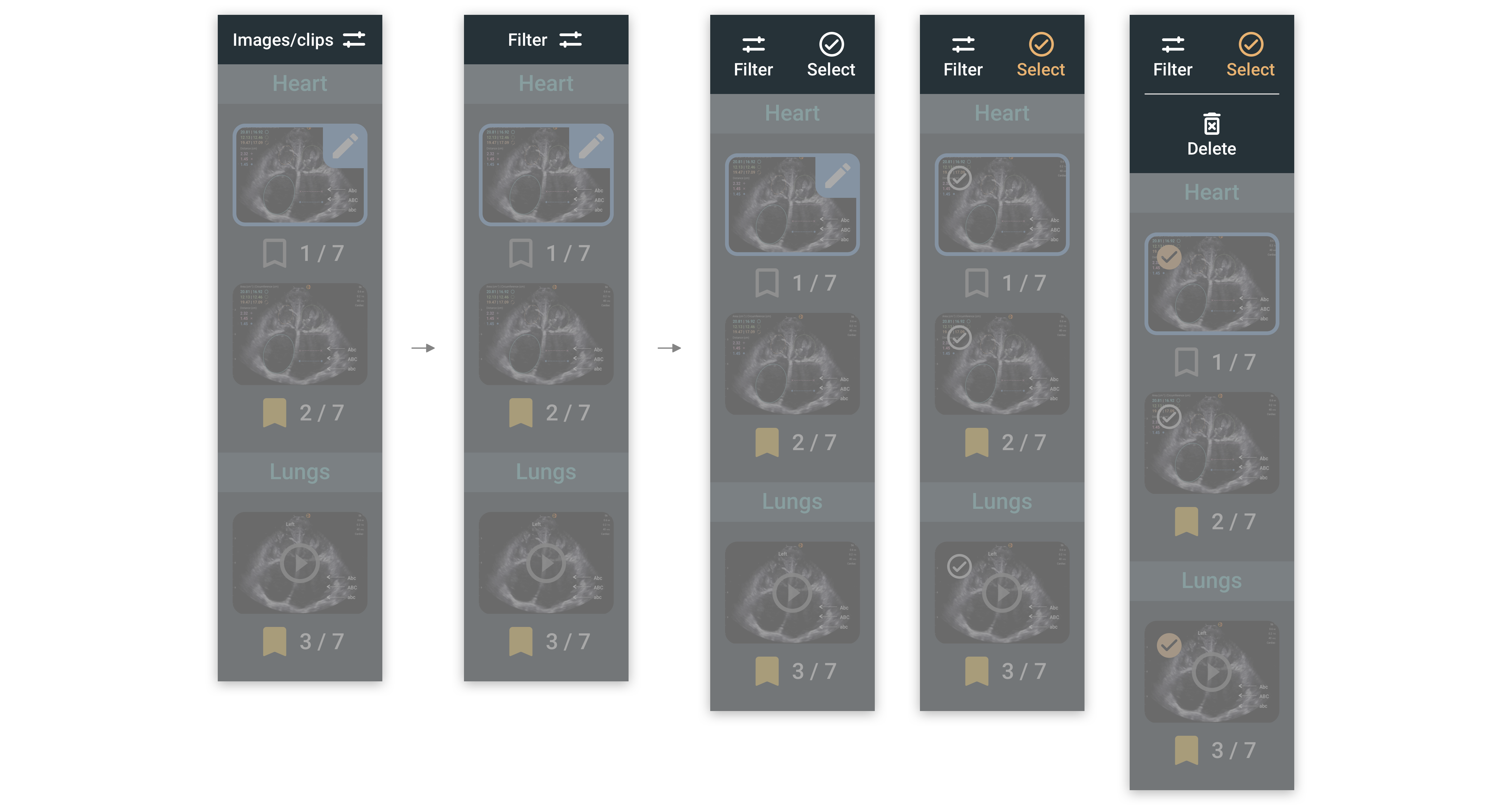 Filter Iteration